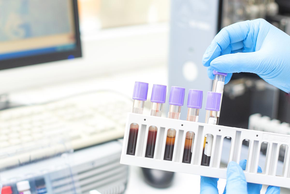 Cardiotoxicity (hERG) Assay